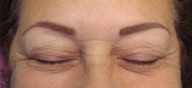 4-30-16_Brows_after_healed.JPG