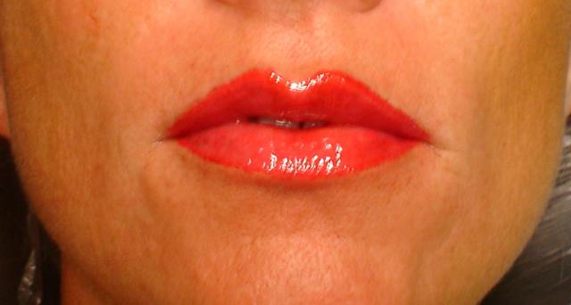 8-15-14_Lips_After.JPG