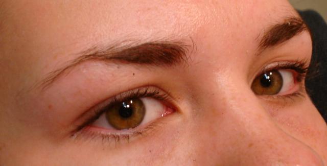 8-20-15_Lashes_Before_side_view.JPG